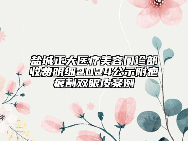 鹽城正大醫(yī)療美容門診部收費(fèi)明細(xì)2024公示附疤痕割雙眼皮案例