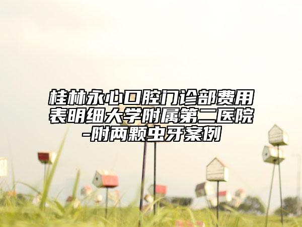 桂林永心口腔門診部費用表明細(xì)大學(xué)附屬第二醫(yī)院-附兩顆蟲牙案例