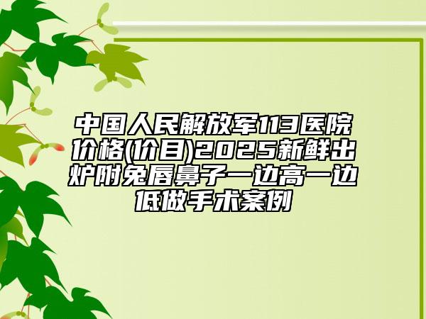 中國人民解放軍113醫(yī)院價格(價目)2025新鮮出爐附兔唇鼻子一邊高一邊低做手術(shù)案例