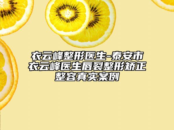 衣云峰整形醫(yī)生-泰安市衣云峰醫(yī)生唇裂整形矯正整容真實(shí)案例