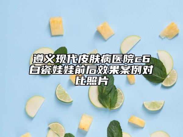 遵義現(xiàn)代皮膚病醫(yī)院c6白瓷娃娃前后效果案例對(duì)比照片