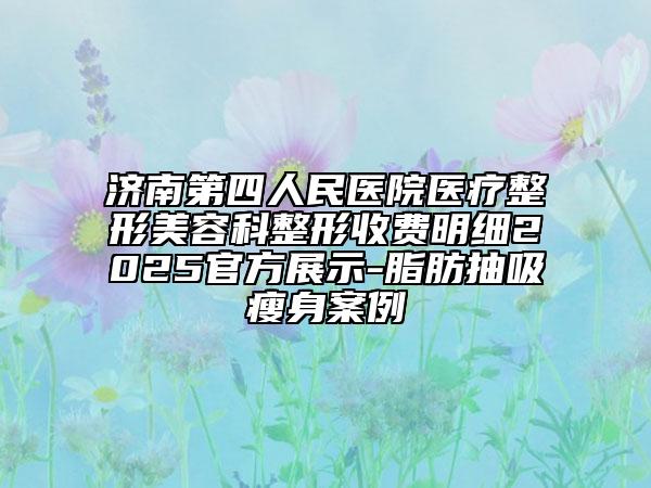 濟南第四人民醫(yī)院醫(yī)療整形美容科整形收費明細2025官方展示-脂肪抽吸瘦身案例