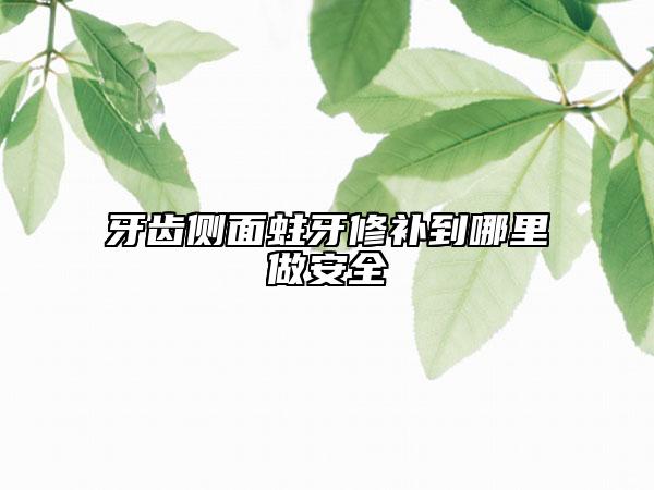 牙齒側(cè)面蛀牙修補到哪里做安全